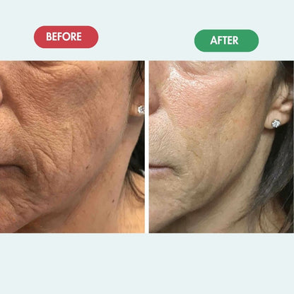 VEORA™ - Regenmask