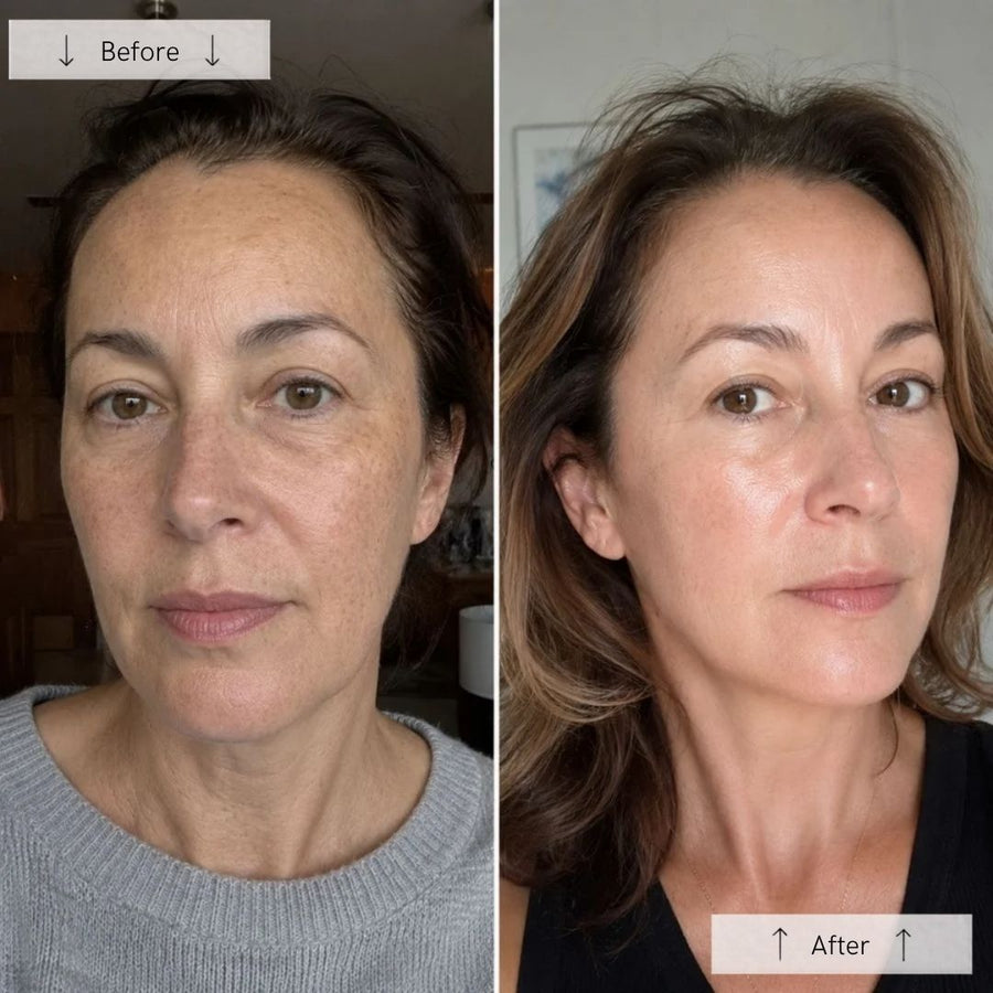 Youthful Glow & Smoother Texture