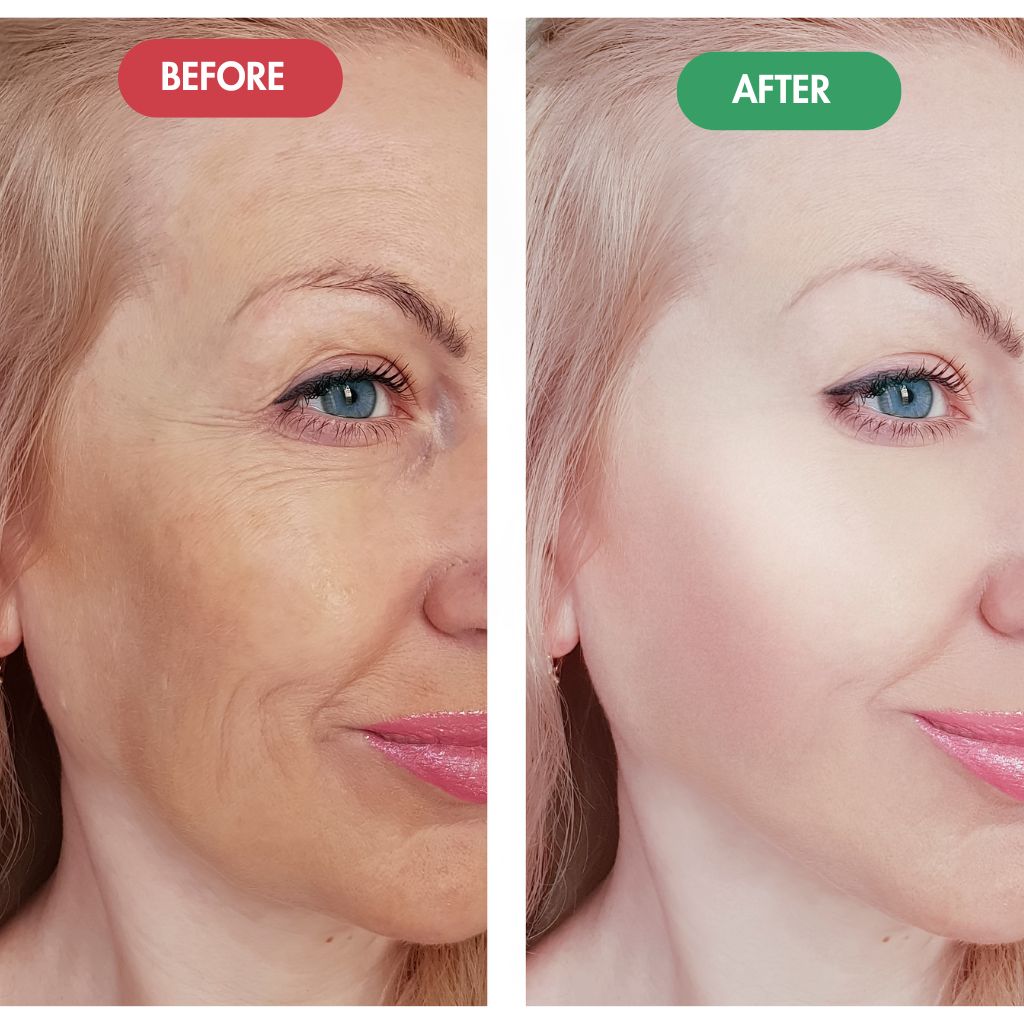 VEORA™ - Regenmask