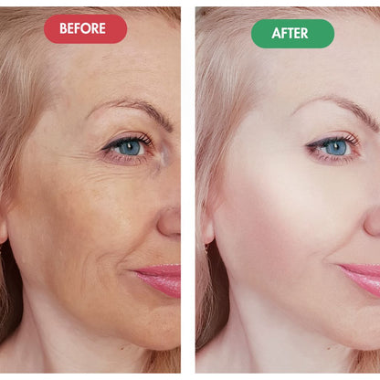 VEORA™ - Regenmask