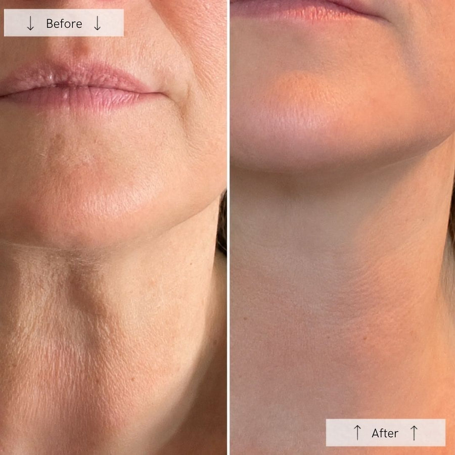 The "Tech Neck" Solution