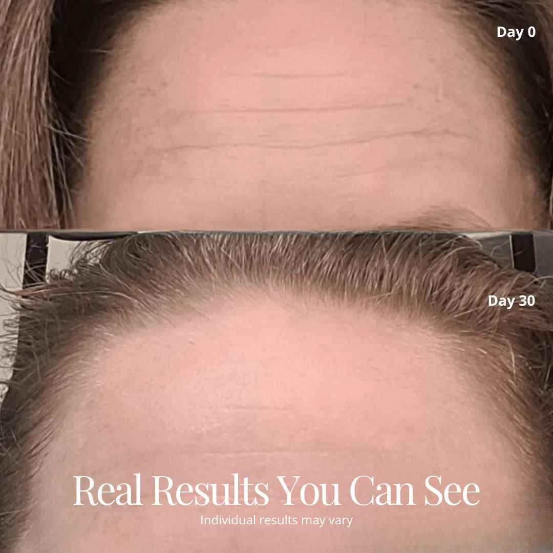 NovaLume RegenMask Pro beauty device with glowing skin results, showing the product and a close-up of a refreshed face.